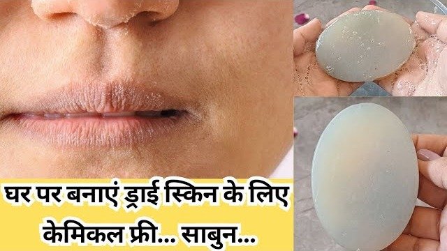 Chemical-Free Homemade Soap for Soft Winter Skin